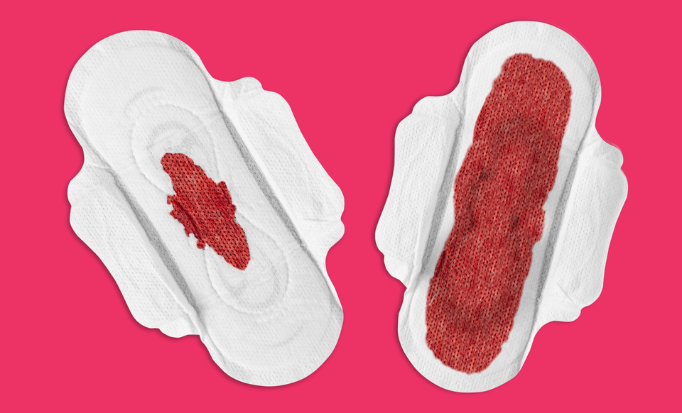 Two sanitary towels. One with a small amount of blood and the second sanitary towel is covered in blood.