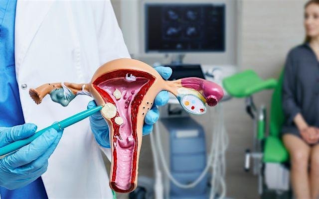 Webinar: Preventing gynaecological cancers-image